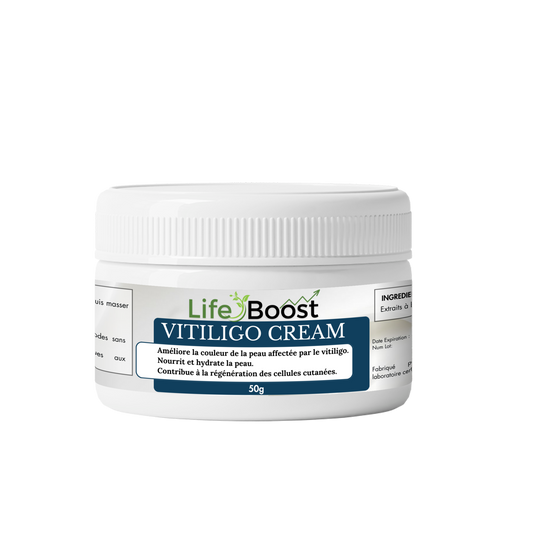 VITILIGO CREAM