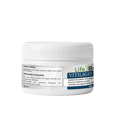 VITILIGO CREAM